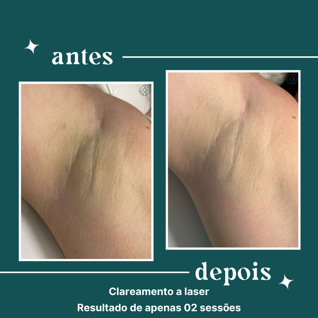 dipelle - para uso comercial (9)