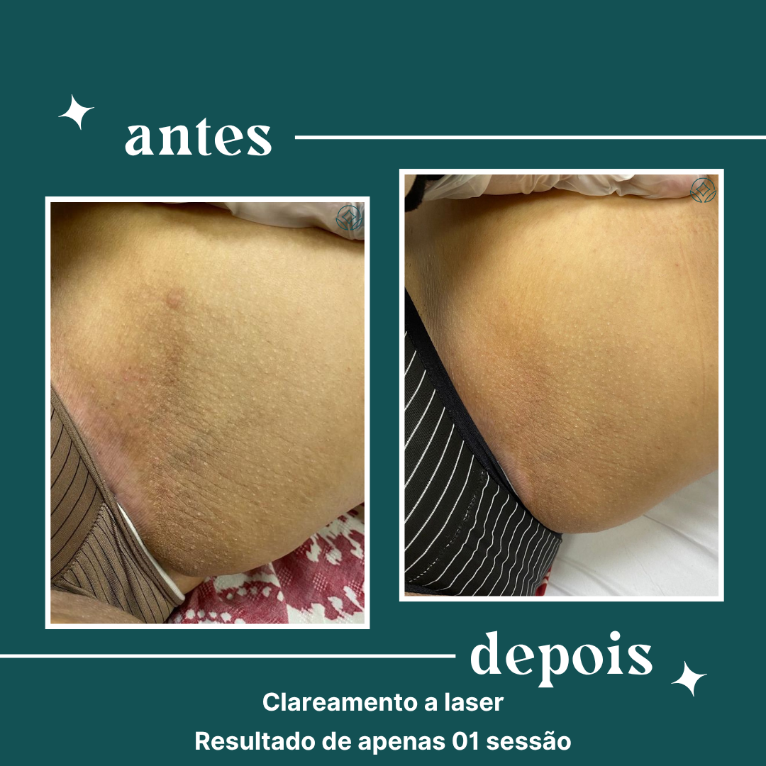 dipelle - para uso comercial (11)