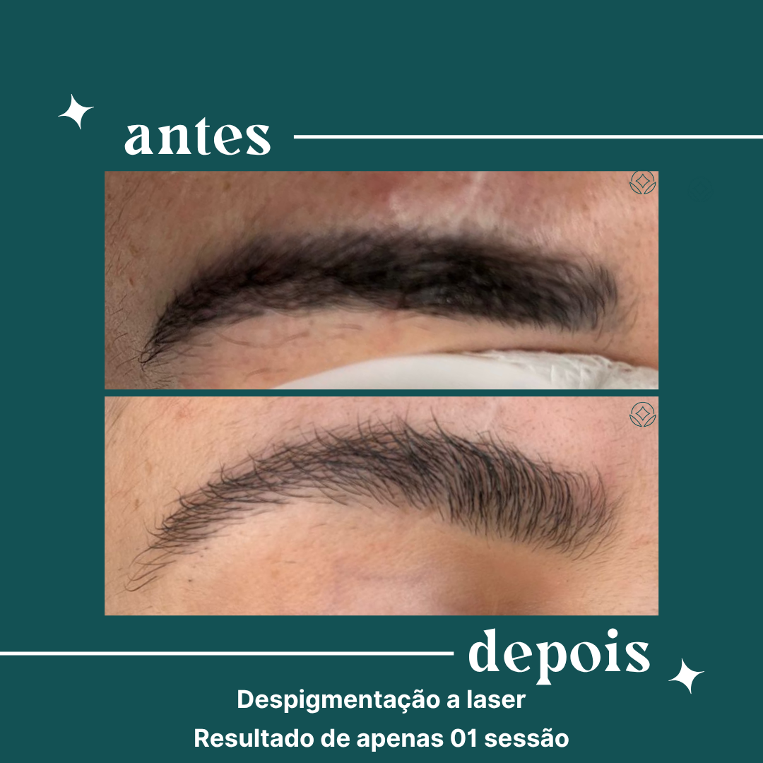 dipelle - para uso comercial (12)