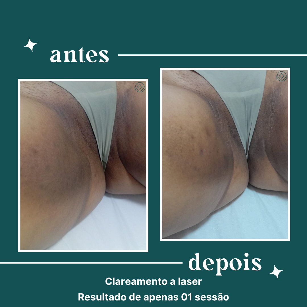 dipelle - para uso comercial (13)