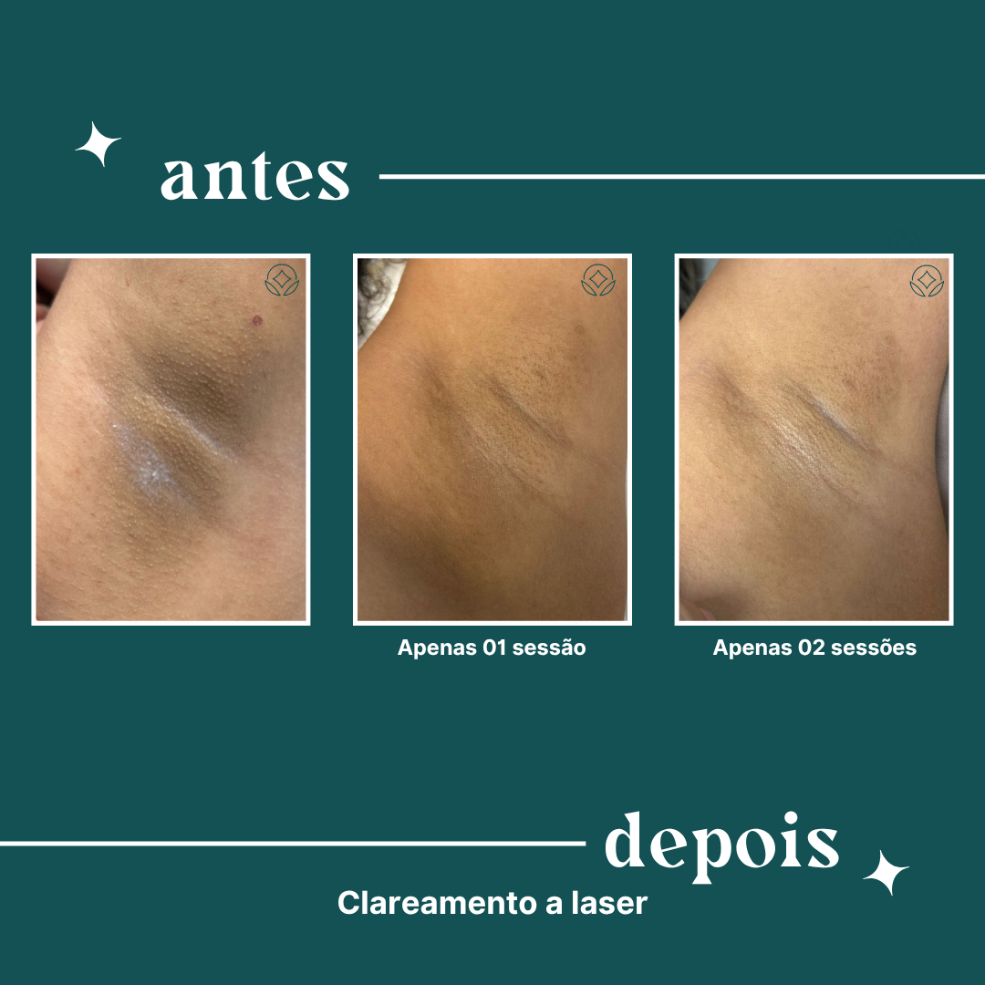 dipelle - para uso comercial (14)